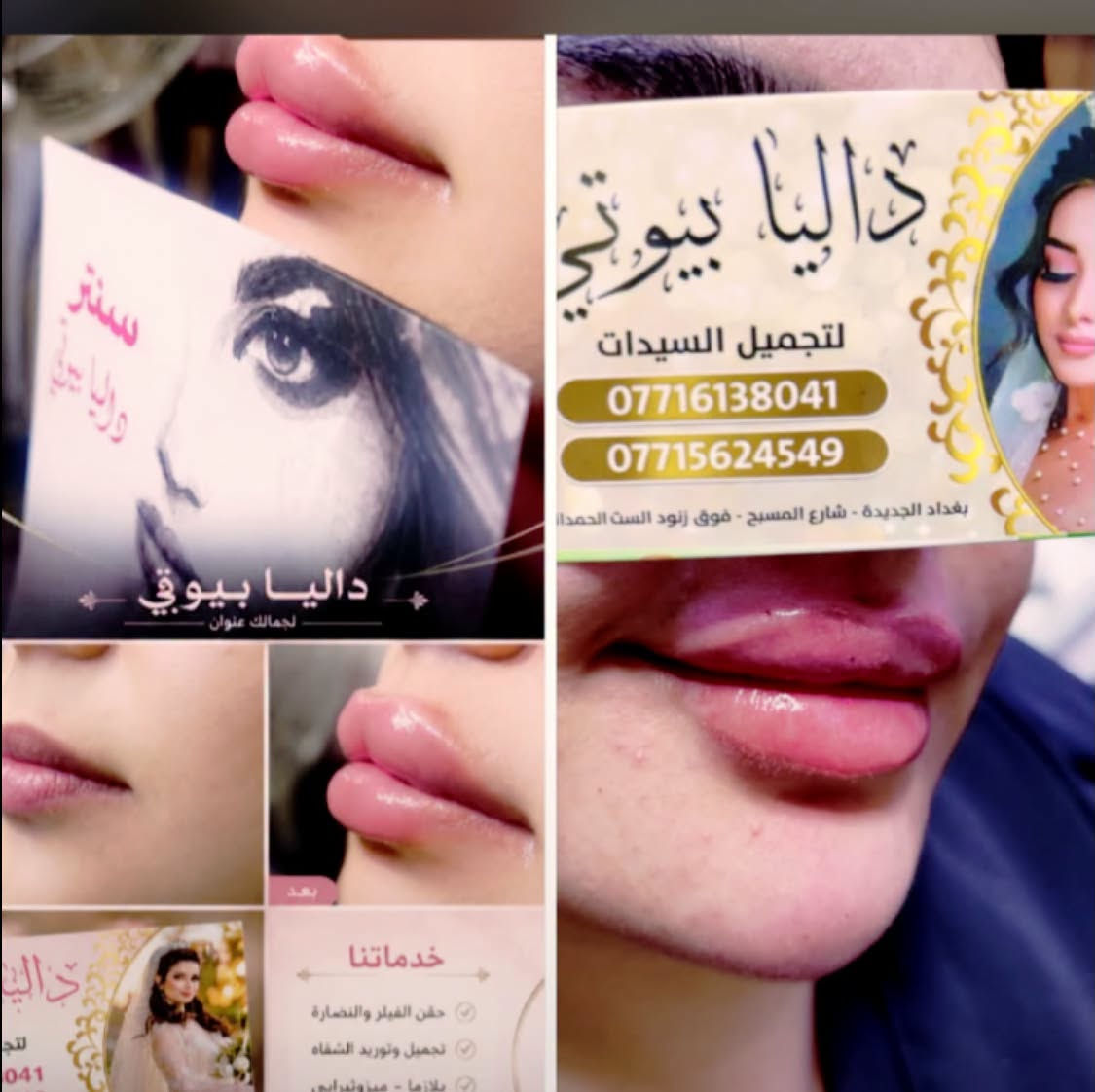 🔥🔥 أقوى عروض داليا بيوتي 🔥🔥
⏰ العرض لمدة 3 أيام فقط ⏰
💥💥 سوي شغلتين والثالثة عليناااا مجاناً 🎁
يعني تدفعين قيمة شغلتين فقط، والثالثة هدية من داليا بيوتي 😍
💇🏻‍♀️ عروض الشعر:
✨ صبغ ميش للشعر القصير — 15 ألف فقط مع هديه قص 
✨ صبغ ميش للشعر الوسط للكتف — 20 ألف فقط مع هديه تريتمنت 
✨ الشعر الطويل والثخين — يحدد بعد المعاينة وعليه خصم حلو 🔥
✨ صبغ + بروتين للشعر التعبان والمتقصف — 20 ألف فقط
✨ ميش + بروتين للشعر التعبان والمتقصف — 20 ألف فقط
✨ سلفون جميع أطوال الشعر — 25 ألف فقط
✨ شسوار جميع أطوال الشعر — 10 آلاف فقط

✨ تسريح الشعر القصير الكاريه — 20 ألف فقط مع هديه معالج 
✨ تسريح الشعر الوسط للكتف — 30 ألف فقط مع هديه معالج 
✨ تسريح الشعر الطويل والأفريقي — يحدد داخل السنتر وعليه خصم وعرض كلش حلو 👑
👁️ الرموش:
✨ رموش طرفية — 5 آلاف فقط
✨ رموش كاملة — 10 آلاف فقط
❤️❤️
💅🏻 الأظافر:
✨ أكرلك إيد + جلش — 15 ألف فقط
✨ أكرلك قدم + جلش — 10 آلاف فقط
✨ جلش — 5 آلاف فقط
✨ دزاين — 5 آلاف فقط
✨ تنظيف إيد — 5 آلاف فقط
💆🏻‍♀️ العناية والجمال:
✨ حف — 5 آلاف فقط
✨ تنظيف بشرة — 5 آلاف فقط
✨ تنظيف قدم — 5 آلاف فقط
✨ هايدرو فيشل — 5 آلاف فقط
✨ قص عادي — 5 آلاف فقط
✨ شسوار شعر ولادي — 5 آلاف فقط
✨ ثقب أذان — 5 آلاف فقط
✨ شامة تاتو — 5 آلاف فقط
✨ وشمة حرف صغير — 5 آلاف فقط
🎁🔥 وتذكريييي:
تسوين شغلتين وتدفعين حساب شغلتين فقط
والشغلة الثالثة هدية مجاناً 🎁😍
🚨 العرض لمدة 3 أيام فقط!
لا تفوتين الفرصة واحجزي موعدچ من هسه 💗
📍 داليا بيوتي
💖 الجمال والدلال… بأسعار ما تتكرر!
العنوان /
الفرع الاول بغداد الجديده شارع المسبح تقاطع النعيريه فوق زنود الست الحمدانيه مقابيل اسواق زيتونه 

الفرع الثاني: بغداد الجديده شارع العام مجاور سنتر حي اور مقابيل باب الخروج لسنتر حي اور 
☎️***********
***********
