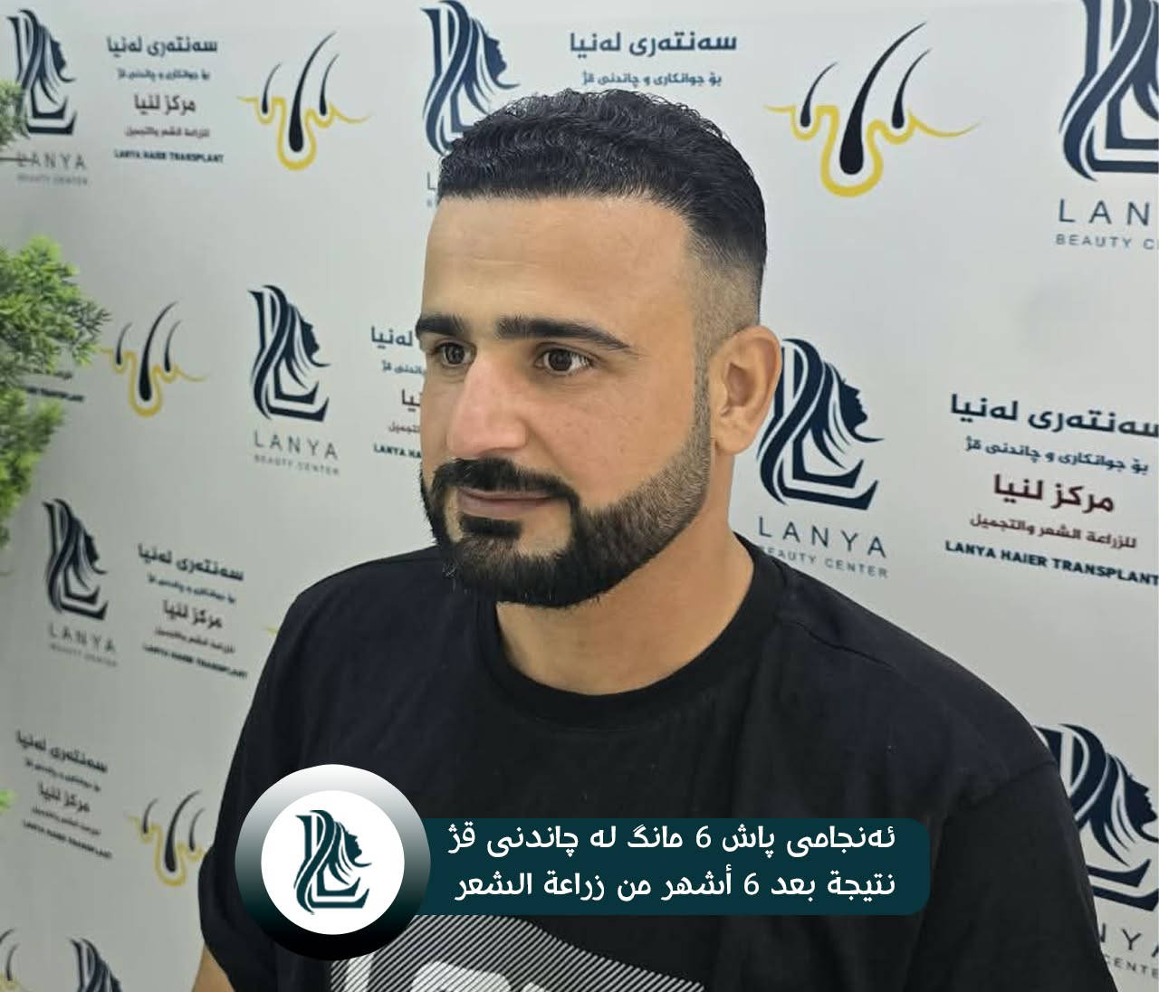 استعد كثافة شعرك من جديد! 
في مركز لەنيا للتجميل و زراعة الشعر ، نساعدك على استعادة مظهر الشعر الطبيعي والأكثر كثافة من خلال زراعة الشعر.
🌿 نتائج طبيعية | 👨‍⚕️ خبرة واحترافية | ✨ عناية بأدق التفاصيل
لەنيا — لأن جمالك يستحق الأفضل. 🤍
♦ مع لەنیا حافظ على شبابك.
📍 العنوان:كلار - شارع ليوا - قرب جامع بخاري
📞 رقم التواصل:
***********
--------
قژێکی پڕتر، متمانەیەکی زیاتر! 
لە سەنتەری جوانکاری لەنیا، بە چاندنی قژ هەنگاوێک بەرەو قژێکی جوانتر و سروشتی‌تر بنێ.
🌿 ئەنجامی سروشتی | 👨‍⚕️ پسپۆڕی | ✨ گرنگیدان بە وردەکاری
♦ لەگەڵ لەنیا هەمیشە بەگەنجی دەمێنێتەوە
📍 ناونیشان: کەلار- شەقامى لیواکە - نزیک مزگەوتی بوخاری
📞 ژمارەی پەیوەندی: ***********
