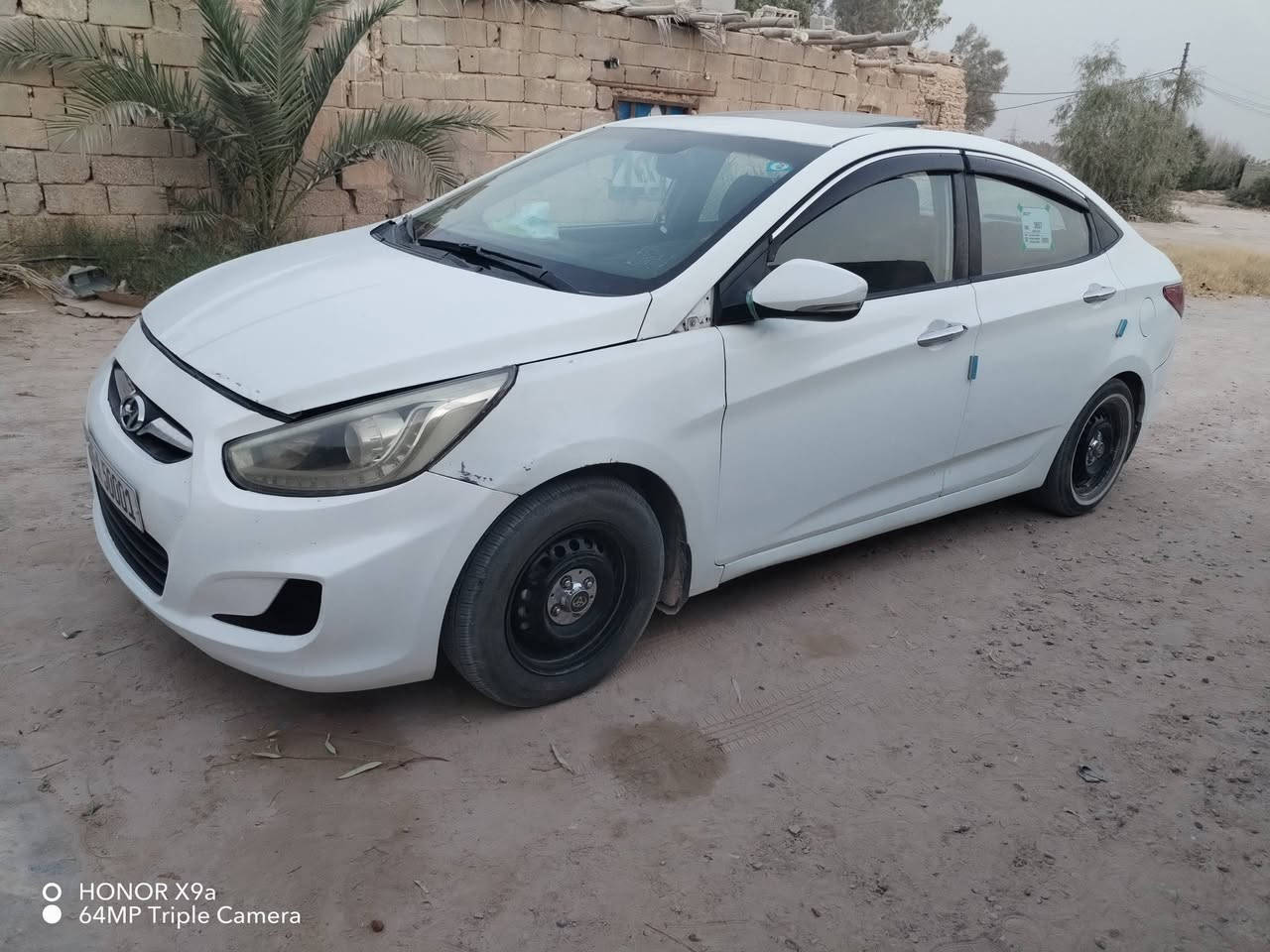 سلام عليكم اكسنت  خليجي  رقم مميز مديل 2016فول موصفات فتحه قماره محرك 1600 المرقوب  تبريد شقال سياره جاهزه من كلشي بيها فقط ضربه بل جاملغ جهت السايق الباقي كفاله السعر 85 وبيها مجال ***********

نص مكتوب في الصور:
- O HONOR X9a
- 64MP Triple Camera
- HONOR X9a