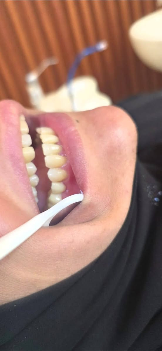 ⁨ ⁨ مهما چانت حالة اسنانك ، نكدر ننقذ ابتسامتك ونرجعها احلى من اول ✨
👨‍⚕️د. سيف رعد مختص في تركيبات الاسنان الثابته
 وحشوات الجذور و اعادة تأهيل الاسنان⁩🦷🦷

للحجز ☎️
 ***********
الموقع 💜
الحريه الدولعي داخل سوق الدولعي ثاني فرع ع اليمين

