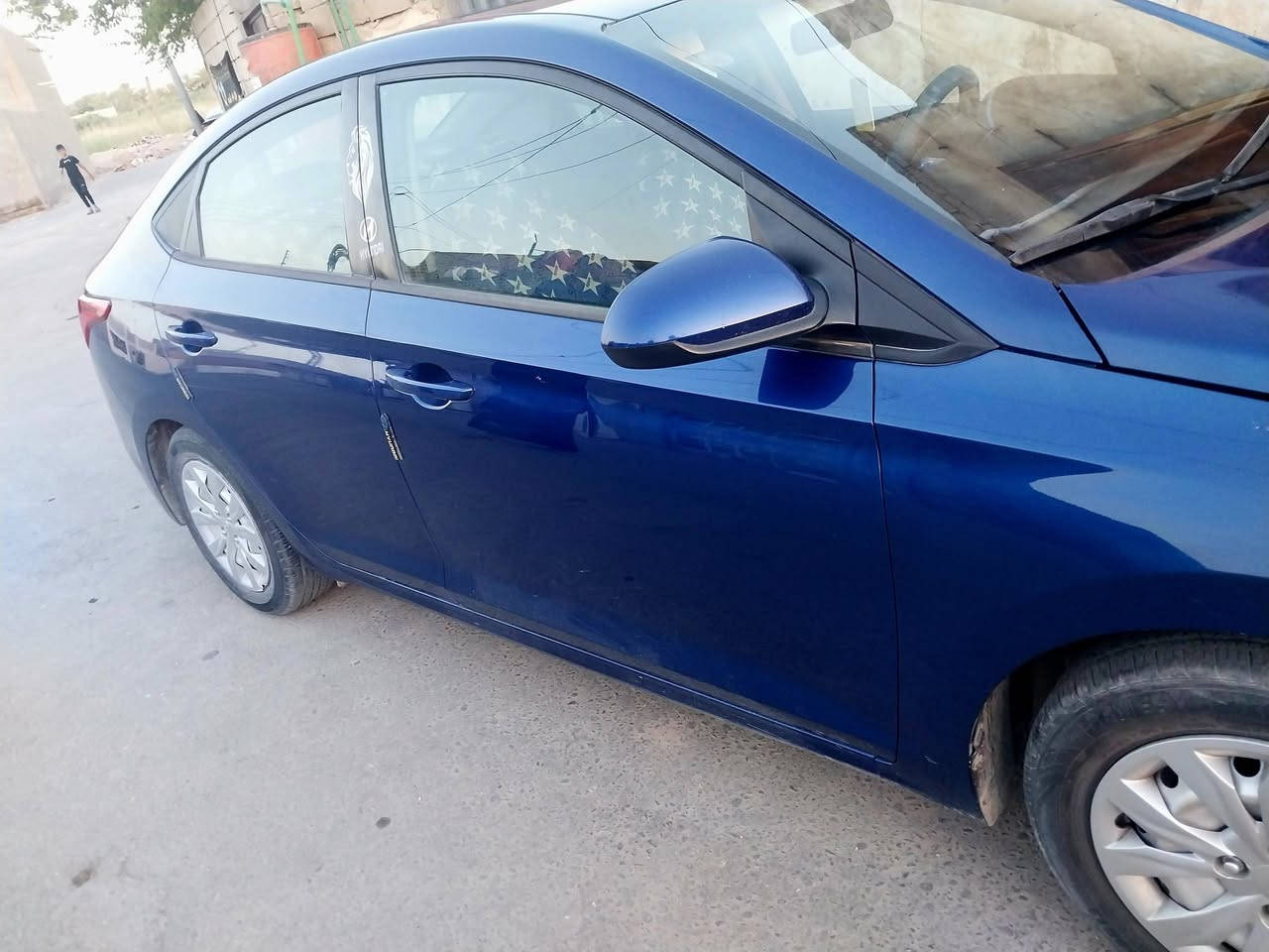 سيارة هونداي اكسنت
موديل 21 امريكي 
رقم مثنى معوقين 
محرك 1600
وكالة عامة بأسمي 
تبريد شغال فول 
بيها قطعتين چاملغ والبنيد والهلال بصفحه السايق معجون 
سيارة جديدة بمعنى الكلمة ومامتعوبة 
سيارة ماتصرف 
ومحرك گير خير من الله 
سعرها 123 وبيها مجال بسيط لجناي
ديوانية
رقمي ***********
