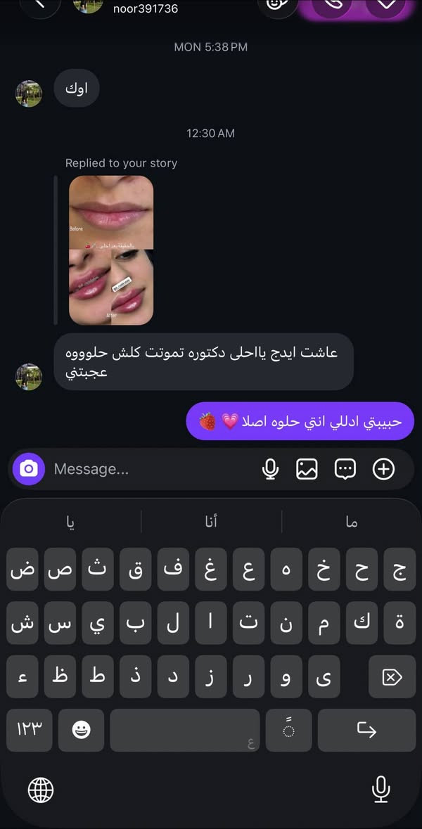 من اجتني كالتلي وين ماروح كلولي متطلع مرفوعه ومكبوسه مراجعتي من فرع بغداد
كلتلها صح شفتج صعبه بس راح احاول بيها واكبسهه وارفعهه حتى يقل من عرضهه !!💉

وهاي النتيجة بعد ماقسمتلهه الابرة على ٣ مراحل وطولت خلك وياهه حتى تطلع بنتيجة تخبل 🍓🍓🍓🍓🍒

شنو رأيكم💉🍓 اهم شي مراجعتي طلعت  راضيه وفرحانه💉
خليتلكم رأيها 🍒🍒🍒🍒🥹

للحجز والاستفسار ***********واتساب

او انستكرام. https://www.instagram.com/p/DbWWdUhsNAt/?stkn=Z2EwenVjcm5rOXFu

او دايركت مسج على الفيسبوك

المسيب/ شارع البلدية
