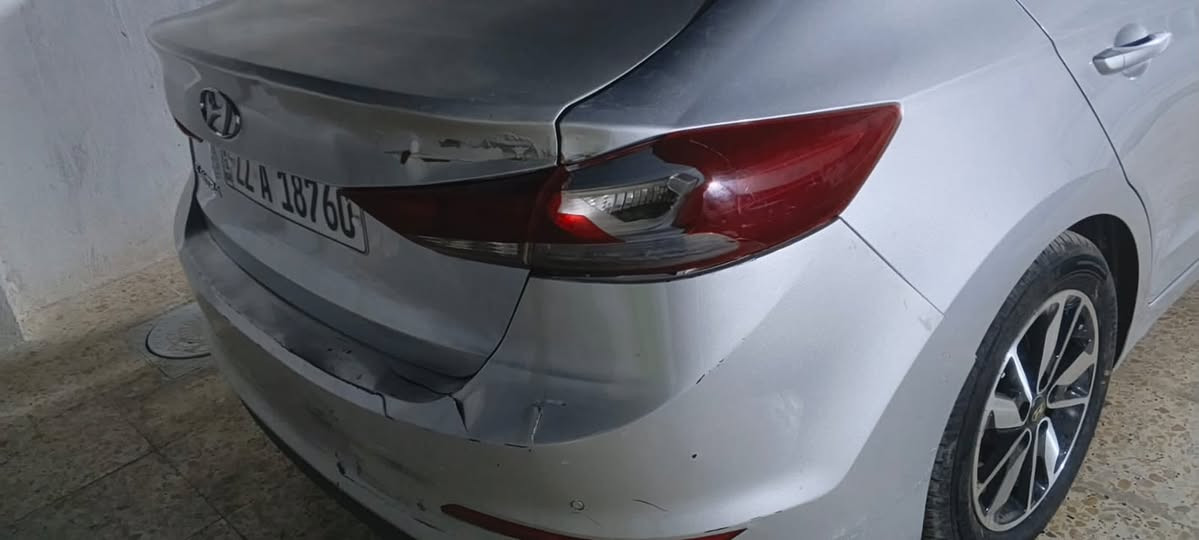 النترا مضلع للبيع
بغداد المشتل مكينه الفين دوش مفتوحه بنيد اودوسه والجنطه بيهن صبغ وحادثها بس دعاميه ولباقي مثل ما موضح بل صوره

موديل ٢٠١٨  السعر شده وخمسه والشراي بي خير ويدلل 

للاستفسار : ***********
