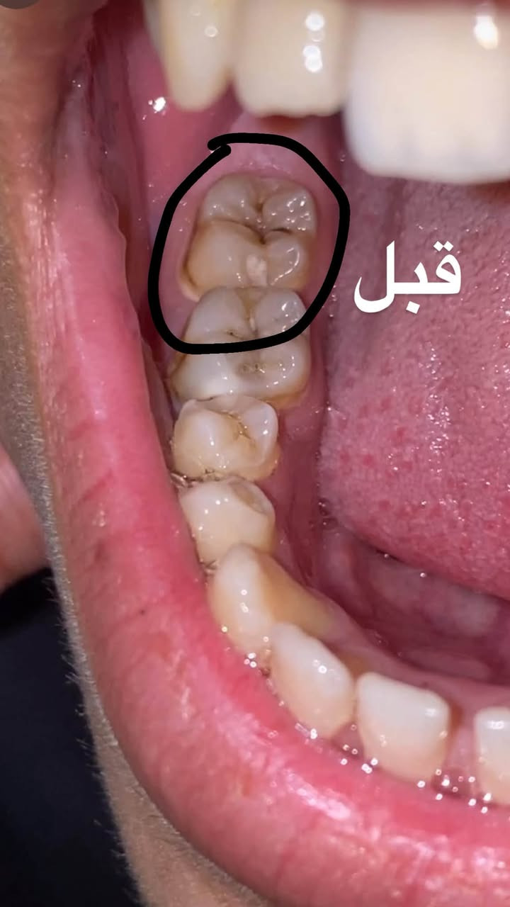 علاج مجاني • أطباء اختصاص • جامعة آشور