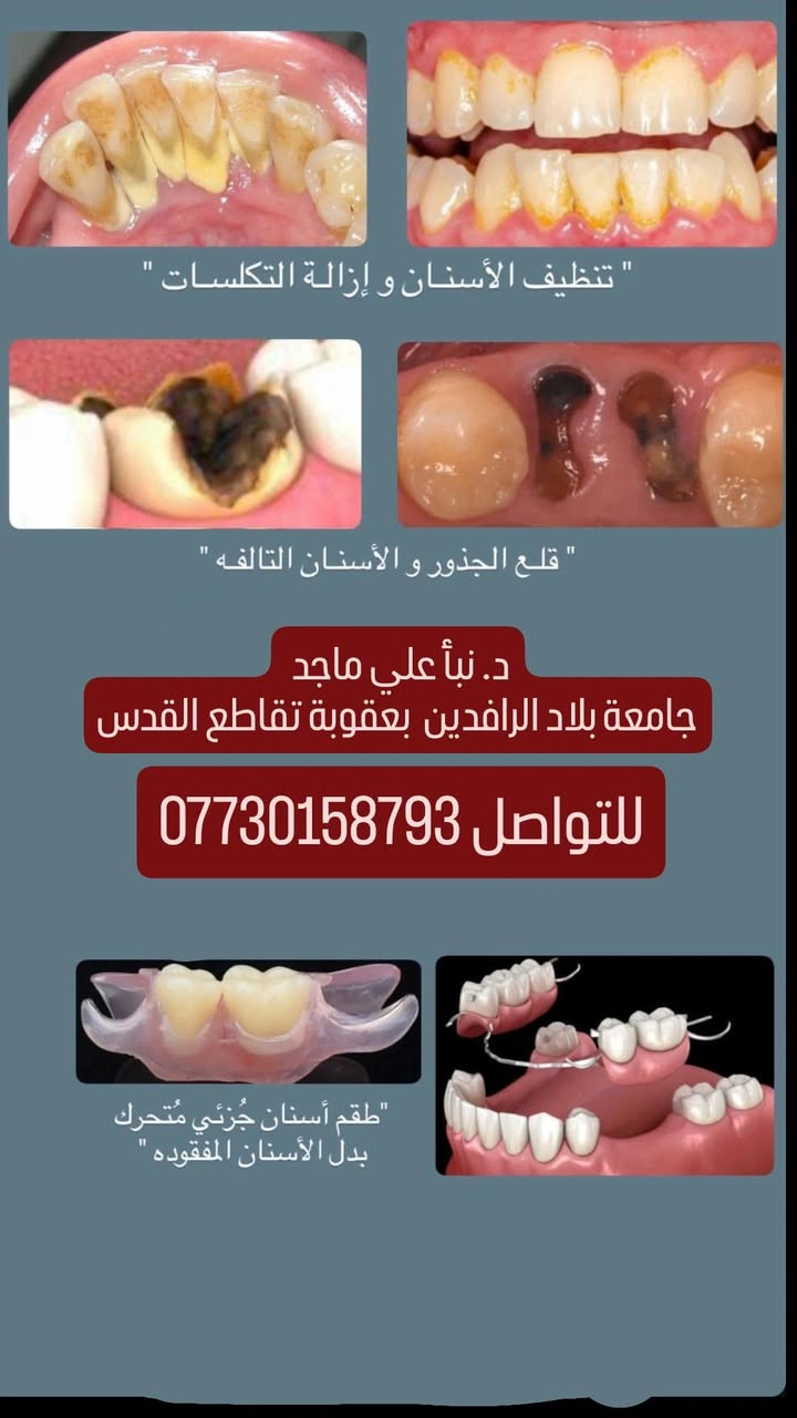 العلاج مجاني ❣️

نص مكتوب في الصور:
- وَمَاتَوْفِيقِي إِلَّا بِاللَّهِ عَلَيْهِ تَوَكَّلْتُ وَإِلَيْهِ أُنِيبُ سورة هود: 88 “ كل بداية جميلة تبدأ بخطوة، وكل نجاح يبدأ بتوفيق من الله. “ الدكتورة نبأ علي ماجد جامعة بلاد الرافدين كلية طب الأسنان الخدمات التي أقدمها فحص شامل واستشارات تخصّصية طقم جزئي متحرك قلع الأسنان والجذور التالفة علاج وحشوات الأسنان التجميلية تنظيف الأسنان وإزالة التكلسات جامعة بلاد الرافدين كلية طب الأسنان العلاج مجاني للجميع تحت إشراف دكاترة اختصاص للحجز والاستفسار *********** _2sa.21@ Instagram @_2sa.05 TikTok @say_601 Telegram _2sa.21 WhatsApp ابتسامة هي أجمل بداية لكل يوم “
- تنظيف الأسنان و إزالة التكلسات
- قلع الجذور و الأسنان التالفه
- د. نبأ علي ماجد
- جامعة بلاد الرافدين بعقوبة تقاطع القدس
- للتواصل ***********
- طقم أسنان جُزئي مُتحرك بدل الأسنان المفقوده
- مواقع التسوسات اللي يتم معالجتها بحشوات ضوئية