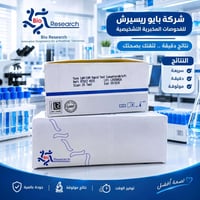 توكسوبلازما • فحص سريع • ٢٥ اختبار