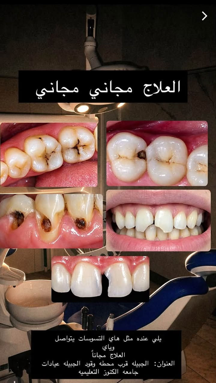 علاج اسنان مجاني • الجبيلة البصرة • عيادات الكنوز