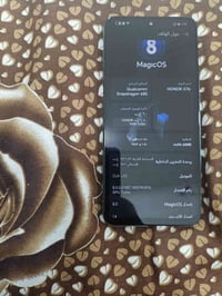 هونر x7b • ٢٥٦ • خدوش بالشاصي