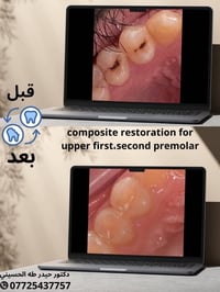 تنظيف أسنان • حشوات أسنان • تعويضات سنية
