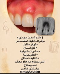 علاج أسنان مجاني • أطباء اختصاص • قلع أسنان
