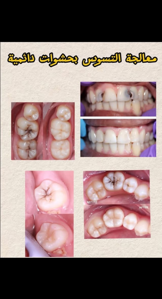كلية طب الأسنان • خدمات مجانية • تنظيف أسنان