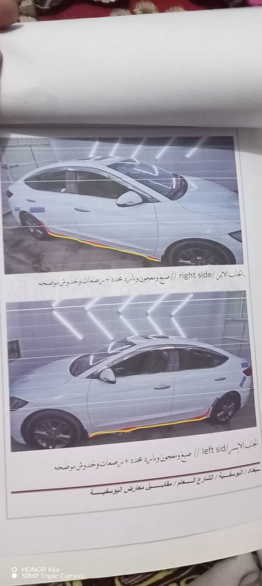 اسلام عليكم النترا 17خليجي
سونار موجود بالمنشور
سياره خير من الله
بأسمي سياره فول مواصفات ما عدا البصمه ***********
***********

نص مكتوب في الصور:
- HONOR X6a
- 50MP Triple Camera
- الجانب الايمن/ right side // صبغ ومعجون وبارد محدد + مرصعات وخدوش موضحه
- الجانب الايسر/ left sid // صبغ ومعجون وبارد محدد + مرصعات وخدوش موضحه
- بغداد / اليوسفية / الشارع العام / مقابل معارض اليوسفية
- الجانب السطحي/ surface side // مرصعات موضحه
- ة الخلفية/ back side// بارد محدد + مرصعات وخدوش موضحه
- داد / اليوسفية / الشارع العام / مقابل معارض اليوسفية