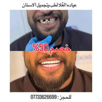 خصم ٥٠٪ • ابتسامة هوليوود • الشرطة الخامسة