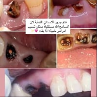 مجاناً • قلع جذور • باچر ١٠ص