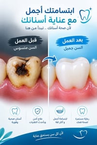 علاج أسنان مجاني • دكتوره طيبه عبد الخالق • مواد أصلية