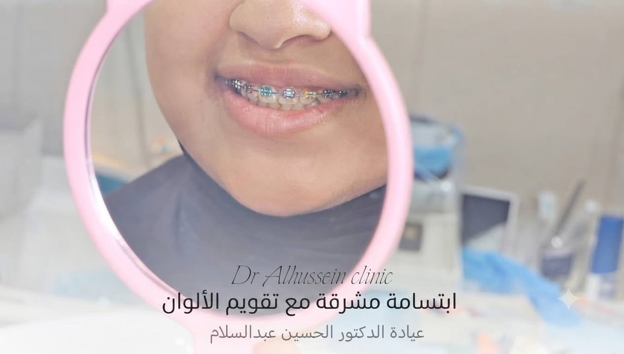 مع تقويم الأسنان في عيادة الدكتور الحسين عبد السلام، نضمن لك خطوات متقنة لابتسامة متناسقة 
اختار ألوان التقويم اللي تحبها وخلي رحلة التغيير مميزة! 🦷
📍 للحجز والاستفسار:
📞 رقم الهاتف: [***********]
📌 العنوان: [ديالى هبهب مدخل هبهب القديمة]
#طب_أسنان #تقويم_أسنان #ابتسامة_هوليوود #عيادة_أسنان #صحة_الأسنان

