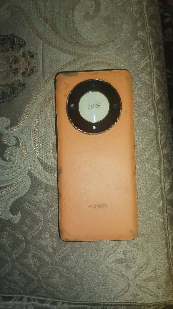 هونر x9bذاكره 256تليفون مثل مشوفون بدلتله ايسي شحن وحط صمغ هواي وصار هيچ  تليفون يخبل /ما ويا غراض فقط كفر /بغداد دوره ابو دشير الضغط ***********
