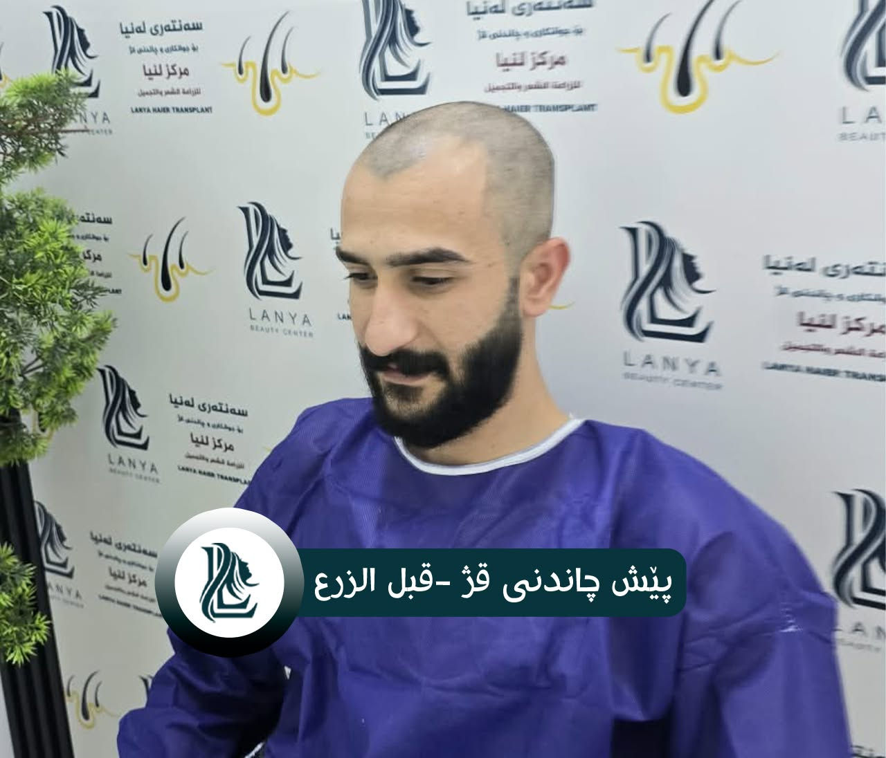 *ودّع فراغات الشعر، واستقبل إطلالة جديدة*
حلول متقدمة ونتائج تدوم.
♦ مع لەنیا حافظ على شبابك.
📍 العنوان:كلار - شارع ليوا - قرب جامع بخاري
📞 رقم التواصل:
***********
🔸🔸🔸🔸🔸🔸
چاندنی قژ لە لەنیا، هەنگاوێک بۆ دڵنیایی و جوانی زیاتر.
🔹 ئەنجامی چاندنەوەی قژی بێ وێنە و ناوازە هەموو کات لە سەنتەری لەنیا دەبینرێت
♦ لەگەڵ لەنیا هەمیشە بەگەنجی دەمێنێتەوە
📍 ناونیشان: کەلار- شەقامى لیواکە - نزیک مزگەوتی بوخاری
📞 ژمارەی پەیوەندی: ***********
