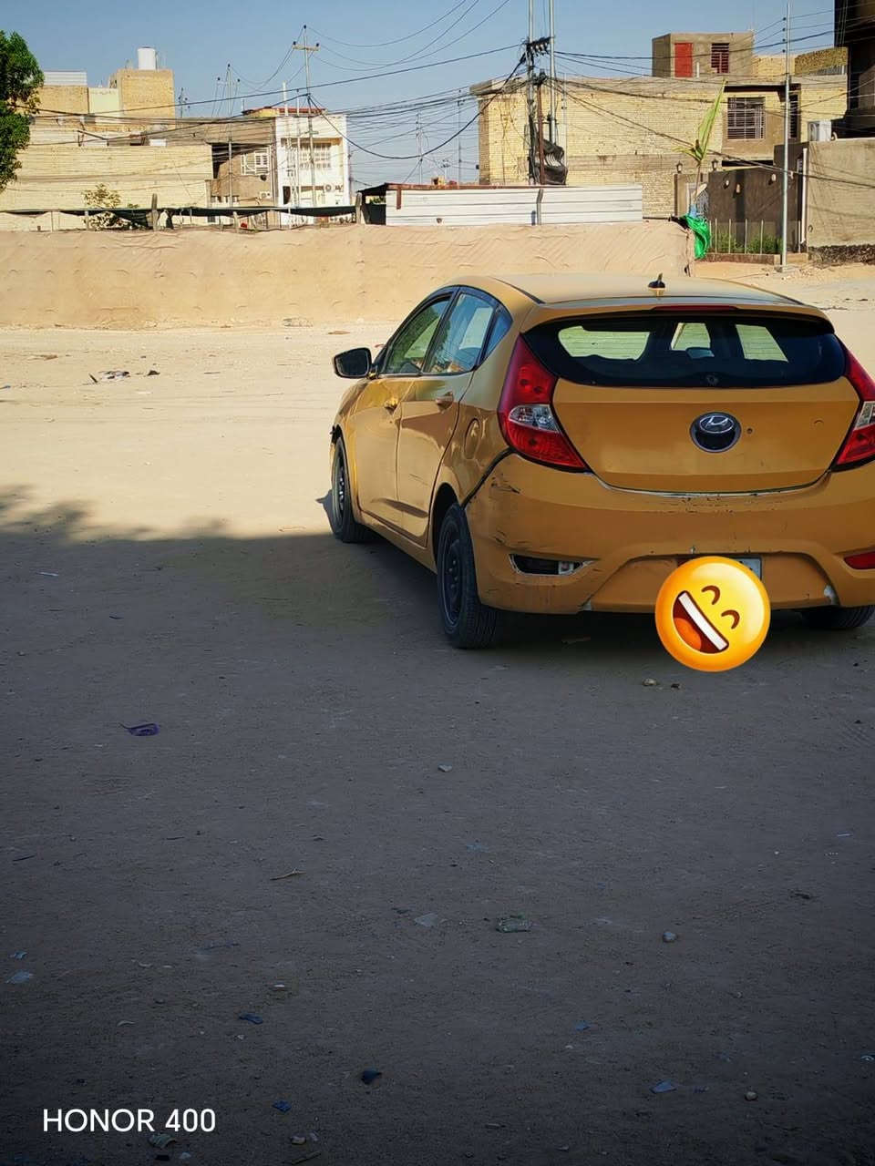 هيونداي اكسنت • للبيع