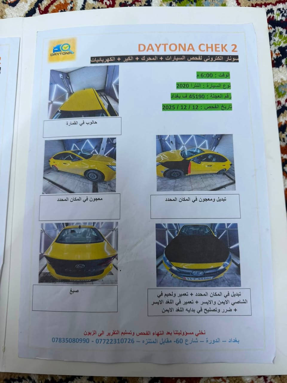 السلام عليكم
النترا موديل 2020
ماشية 80
سونار السيارة موضح بالصور
 سيارة فول مواصفات عدة الفتحة و البصمة
رادار 360 درجة 
كامرة خلفي
المكينة مفتوح بيها كازكيت فقط صلحته قبل شهر 
كير CVT بحالة ممتازة
تخم تاير جديد 
حدادية ممتازة 
سيارة مابيها اي نقص 
فقط مشيول منها حجر صالنصة 
السعر 120 قفل بيها مجال حك الجية
تراي وين ما يعجبك تحويل ثاني يوم السيارة ب اسمي 
رقم التليفون ***********
