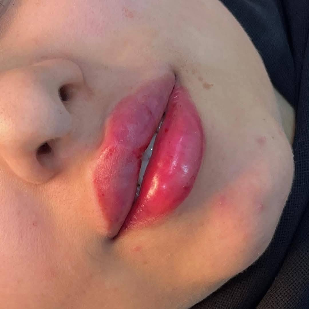عروضنا مازالت مستمره
كل انواع التاتو الحاجب معا 💉ابره نضاره ومثبت لون الحاجب كل هذه الجلسه 30 الف 
📍الشعب مقابل سوق المدينه عيادات الزهراء الطبيه للحجز ولستفسار 📞 ***********
وات ساب

نص مكتوب في الصور:
- Samarhalhad tattoo
- Summer tattoos
- Samar Haddad tattoo