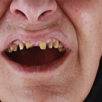زراعة فورية • أقساط ماستر • الديوانية حي الحضارة