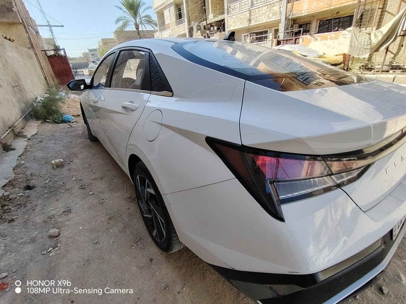 النترة موديل 2024 وارد صيني ماشية 65 سيارة فول مواصفات السعر 158 بيهة مجال مكاني بغداد الرشيدية منطقة الانتصار اتصال علة الرقم لين ما متواجد علة الفيس ***********

نص مكتوب في الصور:
- HONOR X9b
- 108MP Ultra-Sensing Camera
- O HONOR X9b
- O HONOR X9b 108MP Ultra-Sensing Camera
- HONOR X9b 108MP Ultra-Sensing Camera