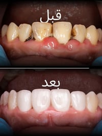 خدمات مجانية • قلع بدون ألم • الكرادة