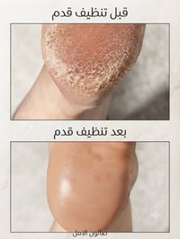 صالون الأمل • تنظيف بشرة • تنظيف قدم