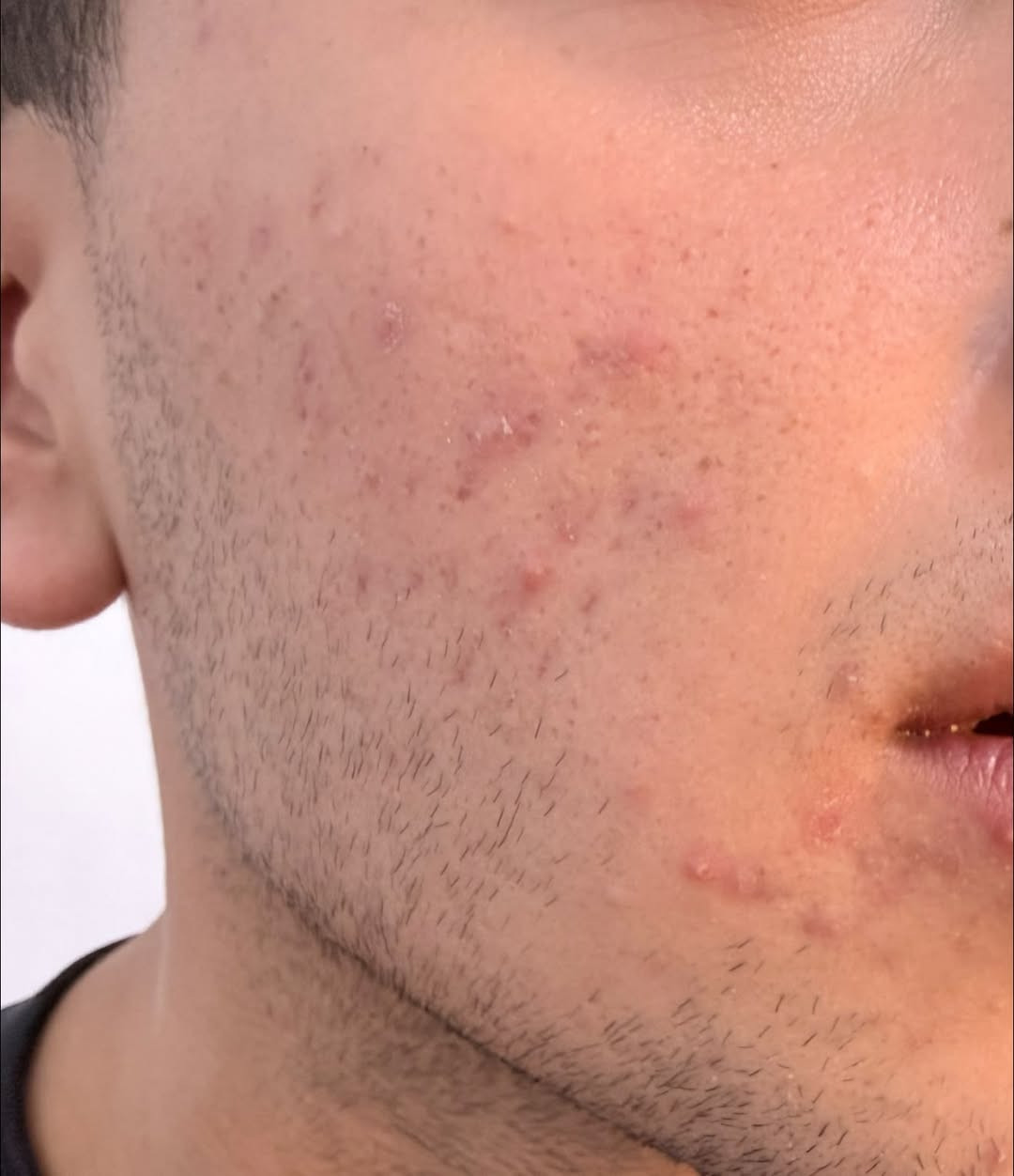 🖤 MEN’S CARE | عناية متكاملة للرجل 🖤

✨ تقطيع الألياف
✨ بلازما PRP للرجال

لإطلالة أكثر نضارة وحيوية…
وعناية احترافية بإشراف مختصين 🤍

👨🏻‍⚕️ عيادة حور
خدمات تجميلية وعناية متخصصة للرجال والنساء

📍 بغداد – الحسينية | السوق الكبير
مقابل مطعم السواعد

📞 ***********
للحجز والاستفسار
