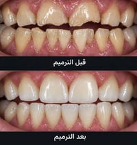 علاج أسنان مجاني • جامعة بابل • الحلة