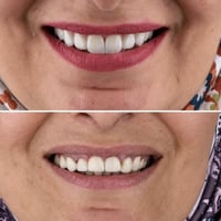 اسنان طبيعية • لثة مستقرة • زعفران به