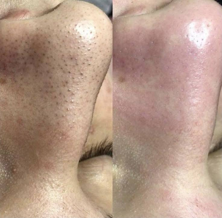 دار آيار للتجميل والعنايه بالبشره والجسم والشعر والاظافروالليزر ***********
