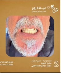 عيادة روح • تجميل أسنان • المحمودية