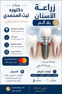 زراعة أسنان • تقسيط • الفلوجه