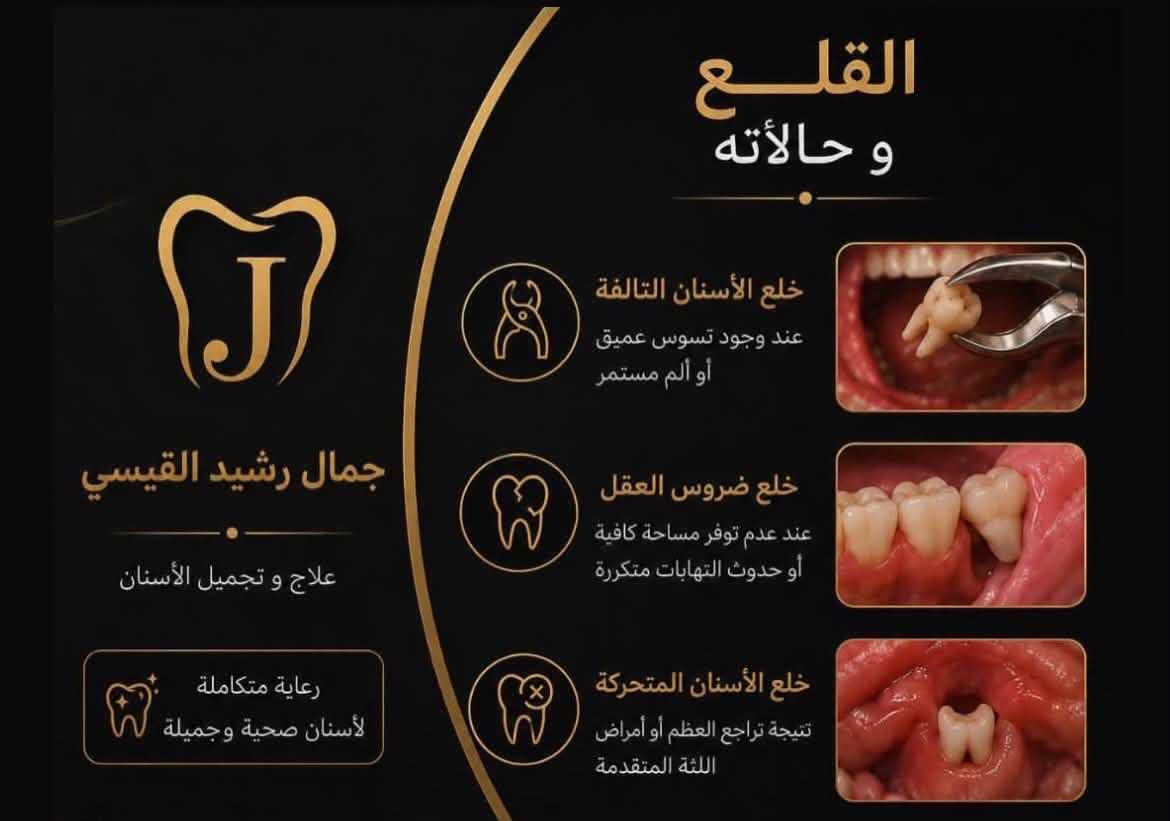 على بركة اللّٰه تعالى...
تستقبل عيادات طب الأسنان في جامعة الإسراء (قرب ساحة الأندلس) المراجعين الكرام لتقديم الخدمات والطبابة السريرية مجاناً بالكامل 100%، وتحت إشراف نخبة من الأطباء الأساتذة.
الخدمات المتاحة حالياً:
﻿﻿قلع الأسنان: قلع عادي وقلع الجذور المتبقية.
﻿﻿تنظيف الأسنان: إزالة التكلسات والعناية باللثة.
﻿﻿الحشوات: حشوات تجميلية (ضوئية) وحشوات
معدنية.
﻿﻿صناعة الأسنان: التعويضات المتحركة (طخم جزئي).📍الموقع: بغداد - جامعة الإسراء (قرب ساحة الاندلس).
للتواصل والاستفسار: [***********]
أهلاً وسهلاً بكم، ونتمنى الصحة والسلامة للجميع .
