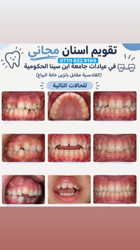 للاستفسار والحجز خاص  نص مكتوب في الصور: - تقويم اسنان مجاني 0770 822 ...