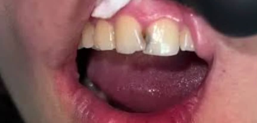 السلام عليكم.
متوفر خدامات (( مجانيه )) داخل العيادة
تنصيف 
وحشوات أمامية وخلفيه مطابقه للون السن. 
وقلع  
وطقم كامل لجميع الاسنان المفقودة 

📍بغداد ،الدورة، جامعة الفارابي 
 *********** 📞
