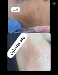 تجميل لاجراحي • عيادة البيان • مقابل المنتدى الثقافي