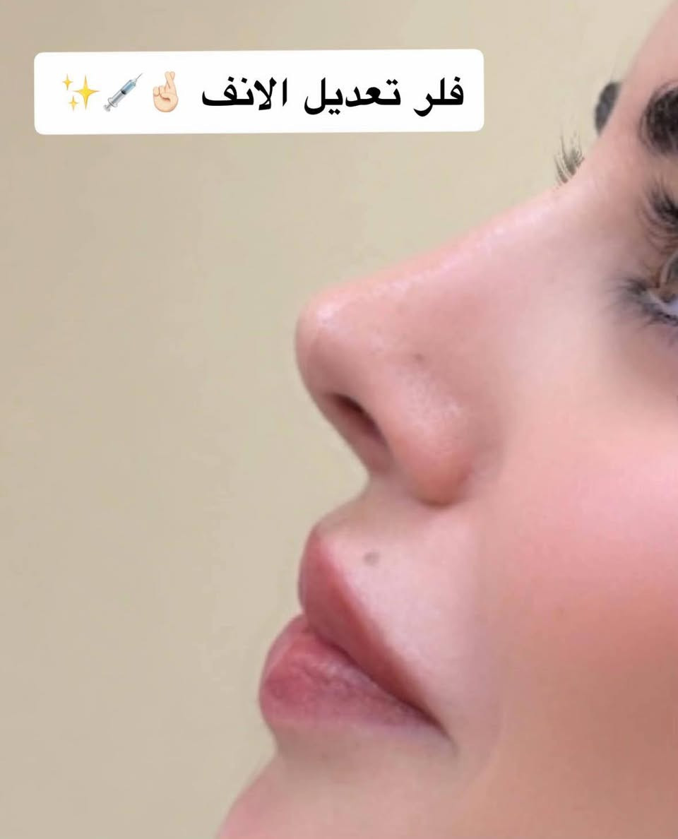 بنات اني بس انشر مرسالة المركز ***********

