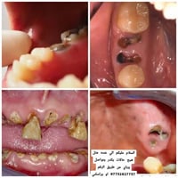 عيادة أسنان • خطة علاج • مجاني