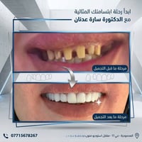 الابتسامة هي أجمل تفصيلة بوجهك.. وهنا نحولها لواقع! 🦷  نص مكتوب في الص...