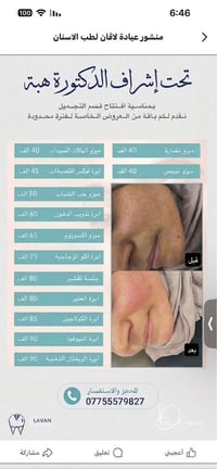 عروض دكتورة هبة حميد للنضاره والفلر والليزر انفتحت الموقع الامين الثان...
