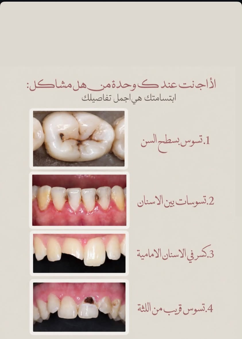 مجاني • قلع الاسنان • طقم جزئي