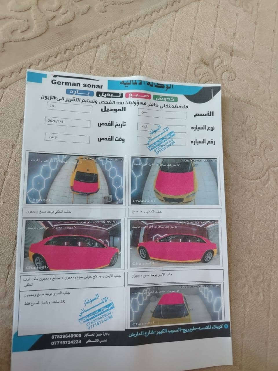 السلام عليكم
اوباما موديل 18اصل
مكينه كير محرك حداديه تبريد سيارة جاهزه
كشنات جلد فول مواصفات عدة الفتحه
سيارة كفاله وهذه السونار مالها بل منشور
خطها شطره كربلاء مكانها شطره
سنويه لل ٢٠٣١  
سعر 235 مجالها بسيط
مكانها شطره
***********
