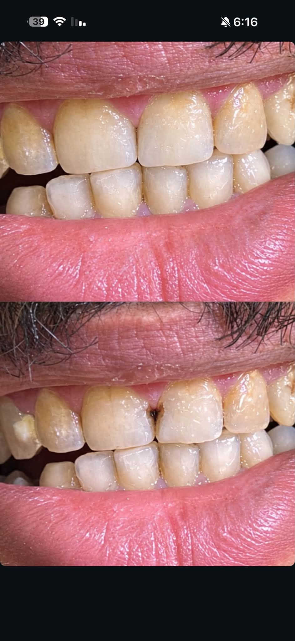 تنظيف اسنان • مجانا • جامعة الزهراوي
