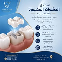 عروض اسنان • زراعة خلال ٤ دقائق • السيدية شارع الخيزران