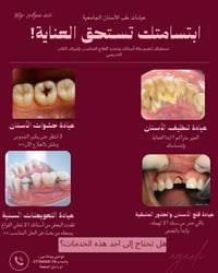عيادات جامعية • تنظيف الأسنان • حشوات الأسنان