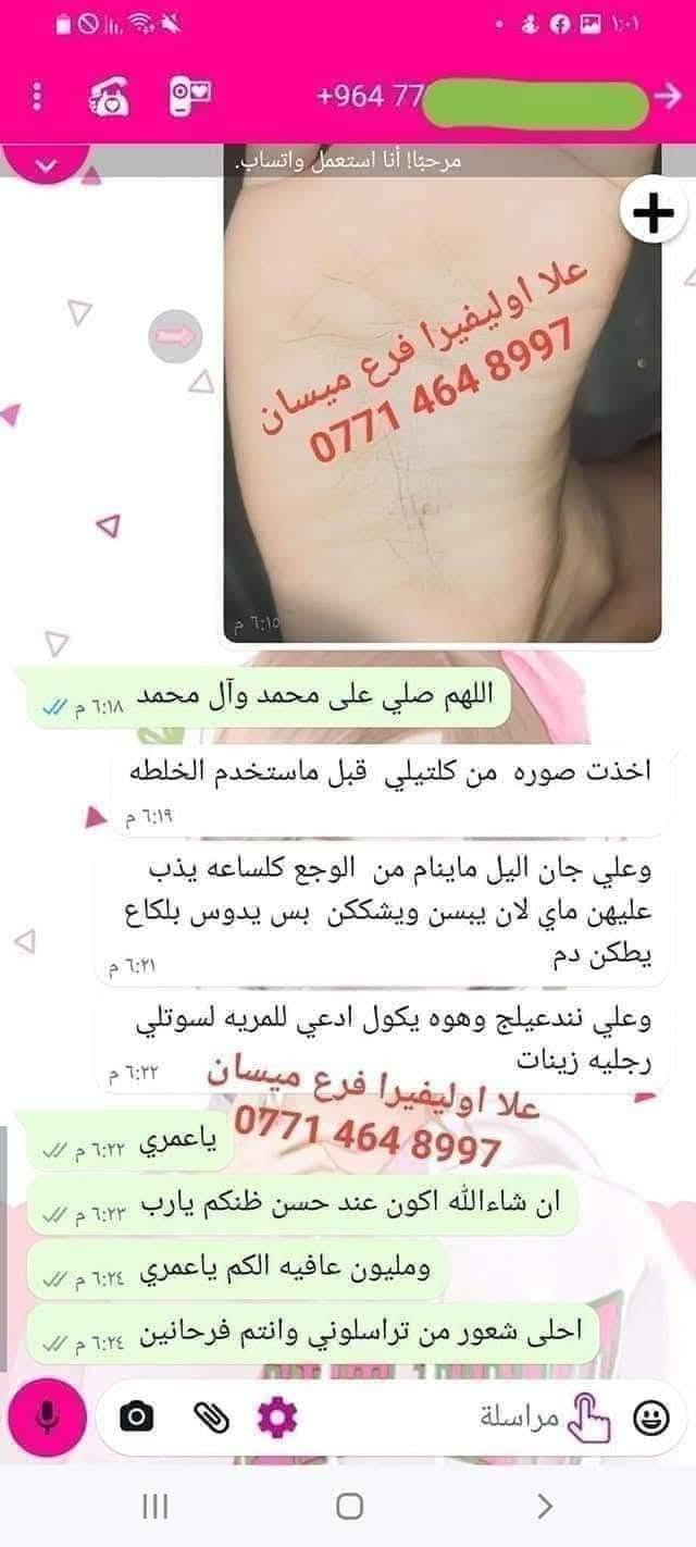سبب حرارة الصيف واغلبيتنه راح نعاني من تشققات الاقدام وخشونتها بسبب الحراره 😞 ولا يهمكم حبايبي جبتلكم كريم علا اوليفيرا السحري المعجزه بكج كامل 🌟الي راح يخلي اقدامكم نااعمه مثل اقدام الاطفال 💎

نص مكتوب في الصور:
- +964 773 877 *********** شوفى رجلينه كلش جانت يصبن دم والله العضيم ٣ ايام خليته اله العلاج وتعالجن رجليه حتى لايده خليت صارن كلش زينات ***********97
- +964776591
- ***********
- BAN
- علا اوليفيرا!
- بان مهدي صالح
- 077
- مراسلة
- علا اوليفيرا فرع ميسان ***********
- +9647732591 *********** علا اوليفيرا ٠٥:١٧ ص بان مهدي صالح شوفي الفرق ٠٥:٢٢ ص خيه انتي رحمه من الله انطاج النه ايدج وعلاجج بي العافيه ٠٥:٢٣ ص صباح الورد ٠٥:٢٩ ص صلوات عل . محمد هآا . محمد مراسلة
- علا اوليفيرا فرع ميسان *********** هاي قبل العلاج علا اوليفيرا فرع ميسان *********** علا اوليفيرا فرع ميسان *********** هاي بعد االعلاج
- وردة
- نشط الآن
- ٧:٥٩ م
- السلام عليكم
- شخبارج
- حبيت اشوفج الفرق
- ***********
- قبل
- بعد
- علا اوليفيرا فرع ميسان
- ربي يرزقكم ان شاء الله
- ٨:١٩ م
- اللهم صلي على محمد وآل محمد
- لقد قمت بالرد على وردة
- وعليكم السلام ياقلبي
- Aa
- +964 77 2599
- ايي هم نسيت ٠٩:٣٤ م
- ***********
- هاي رجليه اليوم ٠٩:٣٤ م
- بعد استخدام مره وحده ٠٩:٣٥ م
- احسن صار ٠٩:٣٥ م
- صارن ٠٩:٣٥ م
- لصق
- مرحباً! أنا استعمل واتساب. +964 77 علا اوليفيرا فرع ميسان *********** اللهم صلي على محمد وآل محمد اخذت صوره من كلتيلي قبل ماستخدم الخلطه وعلي جان اليل ماينام من الوجع كلساعه يذب عليهن ماي لان يبسن ويشككن بس يدوس بلكاع يطكن دم وعلي نندعيلج وهوه يكول ادعي للمربه لسوتلي رجليه زينات علا اوليفيرا فرع ميسان *********** ياعمري ان شاءالله اكون عند حسن ظنكم يارب ومليون عافيه الكم ياعمري احلى شعور من تراسلوني وانتم فرحانين مراسلة
- علي اولفيرا فرع
- ميسان
- شوفي النتيجه