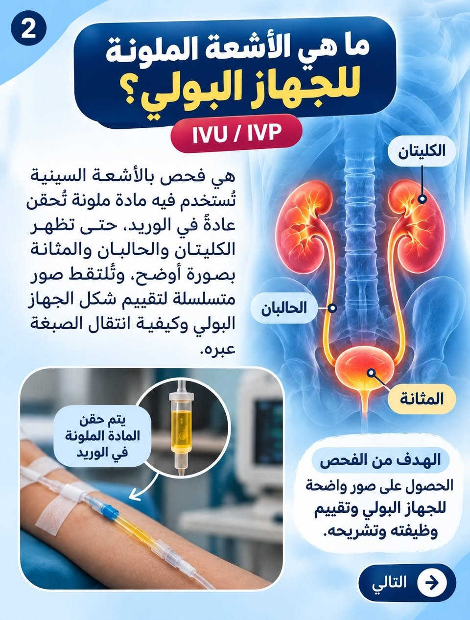 أشعة ملونة • الجهاز البولي • مستشفى الزهراء الأهلي